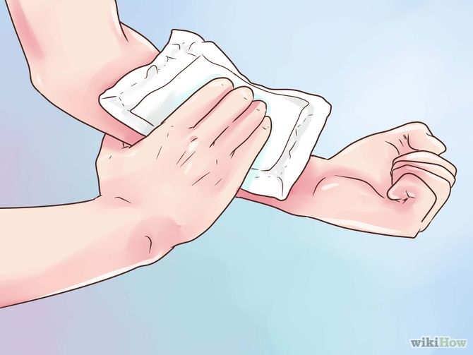 Ice an Injury Step 1.jpg