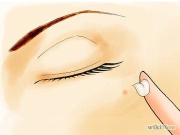 Avoid Acne Step 16 Version 4.jpg