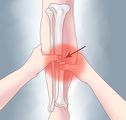 Make a Sling for Your Arm