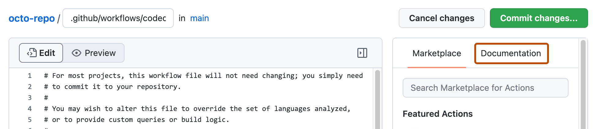 Screenshot: Startworkflowdatei, die zur Bearbeitung geöffnet ist. Die Schaltfläche „Dokumentation“ ist mit einem orangefarbenen Umriss hervorgehoben.